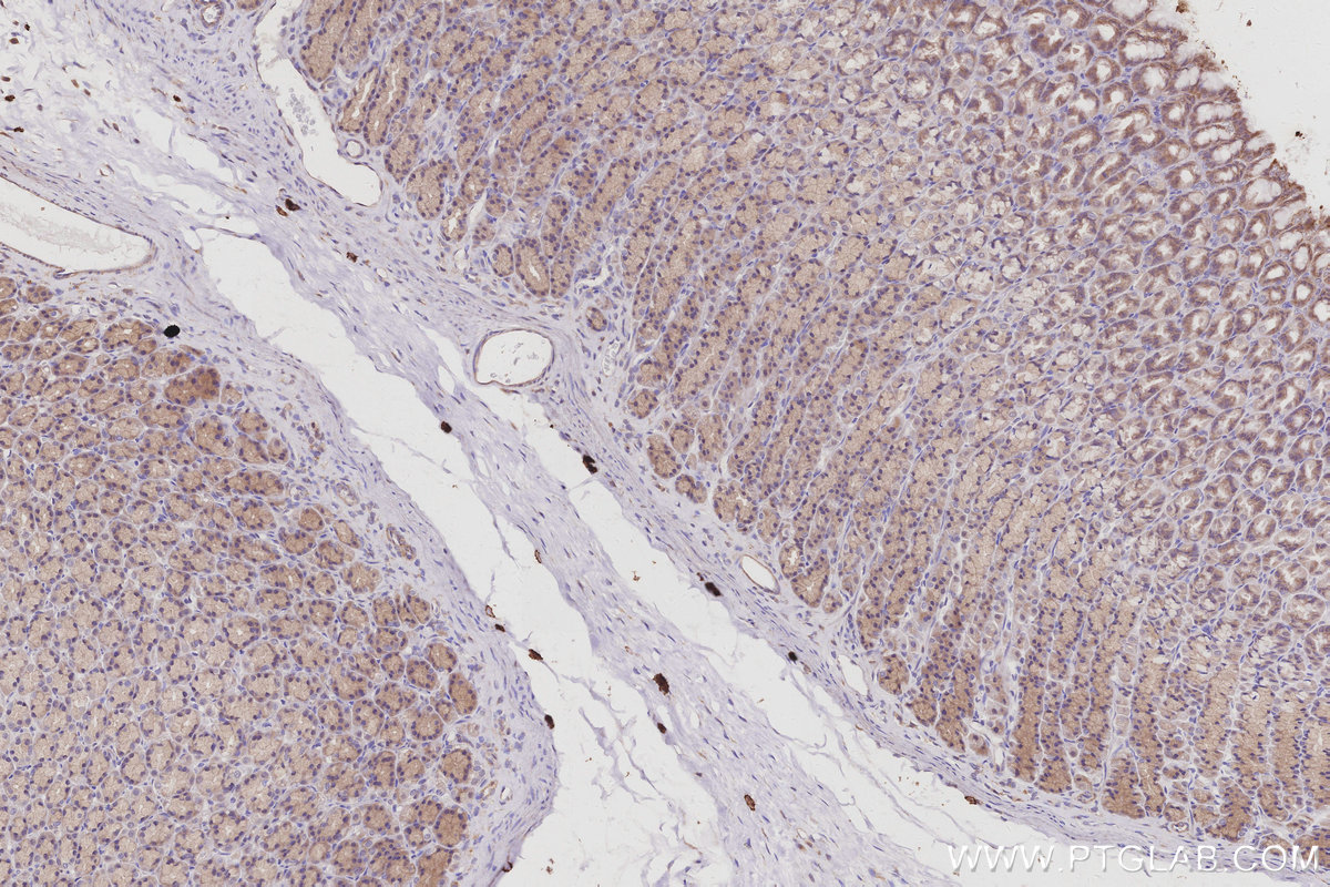 Immunohistochemical analysis of paraffin-embedded rat stomach tissue slide using KHC3001 (RPS6KB2 IHC Kit). Immunohistochemical analysis of paraffin-embedded rat stomach tissue slide using KHC3001 (RPS6KB2 IHC Kit).