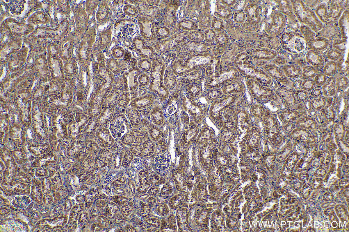 Immunohistochemical analysis of paraffin-embedded mouse kidney tissue slide using KHC0662 (RRBP1 IHC Kit).