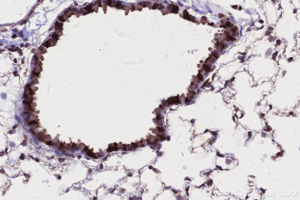 Immunohistochemical analysis of paraffin-embedded mouse lung tissue slide using KHC2745 (RSPH1 IHC Kit).