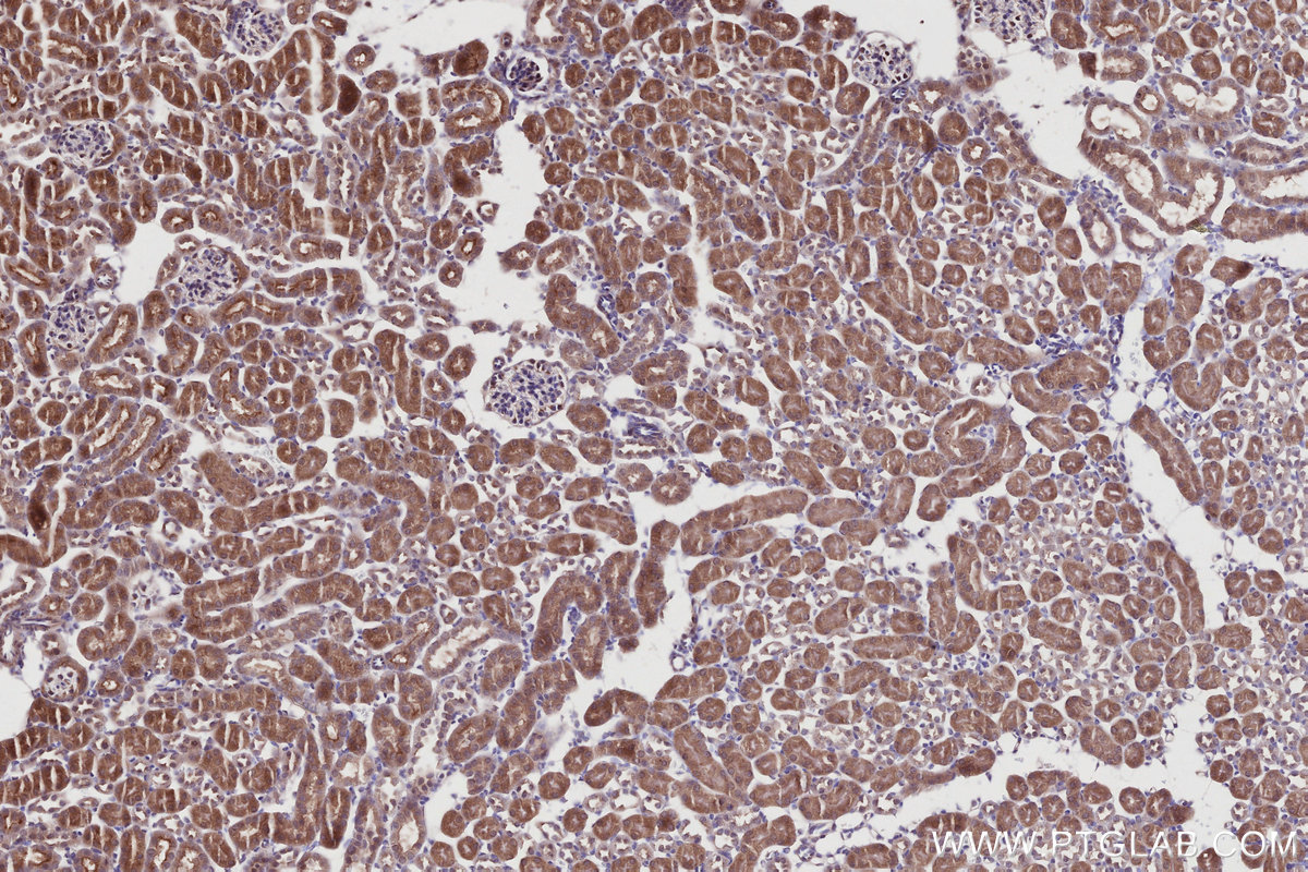 Immunohistochemical analysis of paraffin-embedded mouse kidney tissue slide using KHC2745 (RSPH1 IHC Kit).