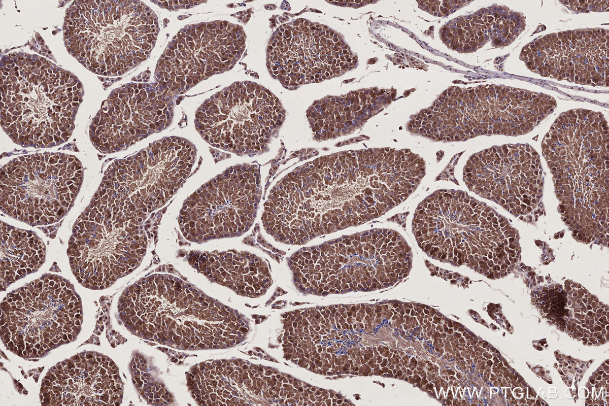 Immunohistochemical analysis of paraffin-embedded mouse testis tissue slide using KHC2745 (RSPH1 IHC Kit).