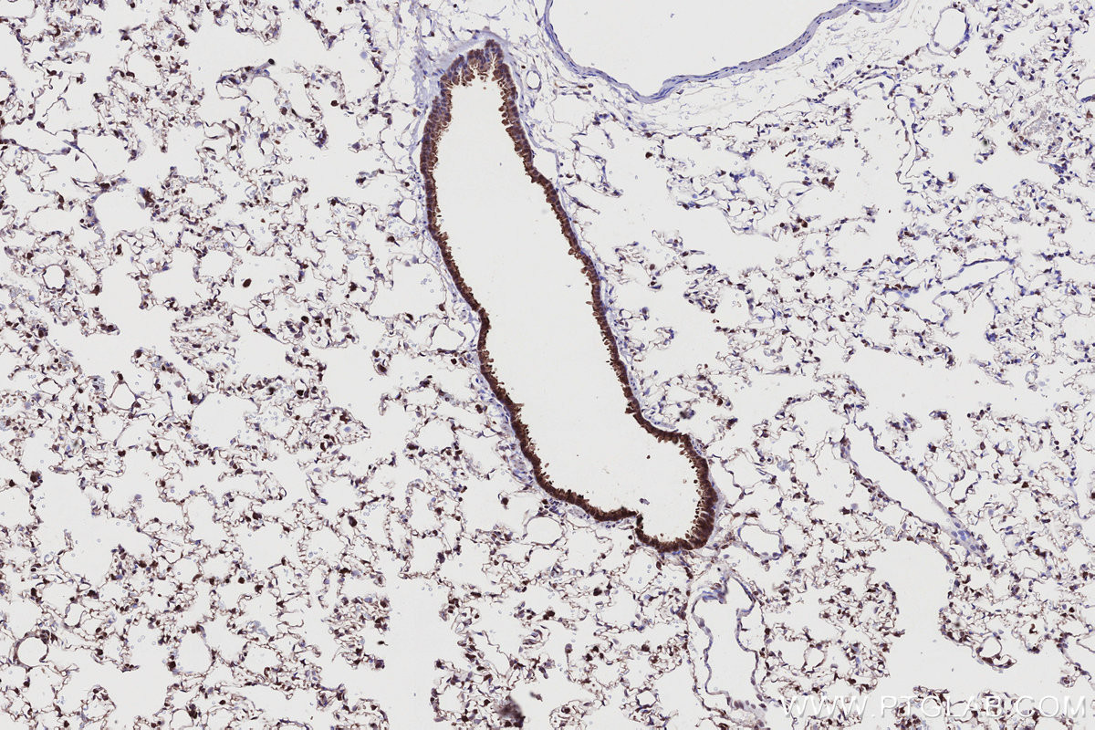 Immunohistochemical analysis of paraffin-embedded rat lung tissue slide using KHC2745 (RSPH1 IHC Kit).