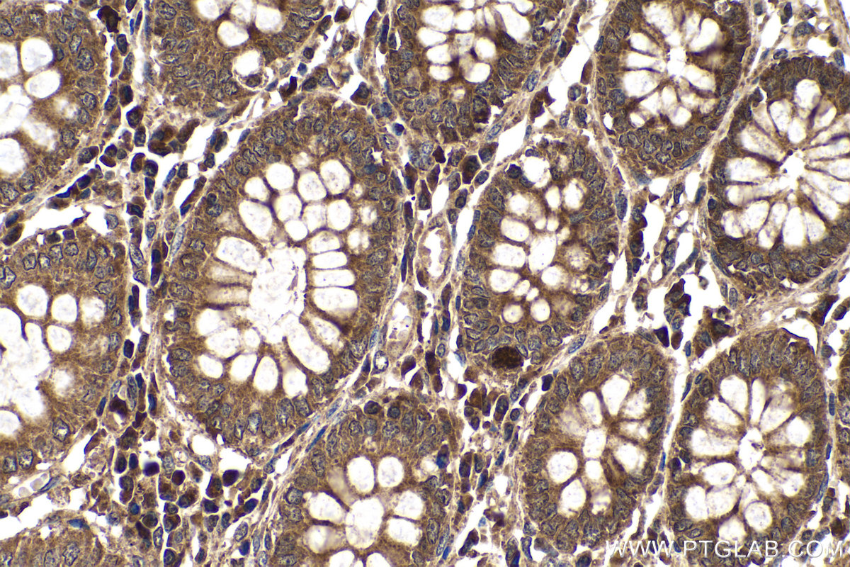 Immunohistochemical analysis of paraffin-embedded human colon tissue slide using KHC0225 (RSPO1 IHC Kit).