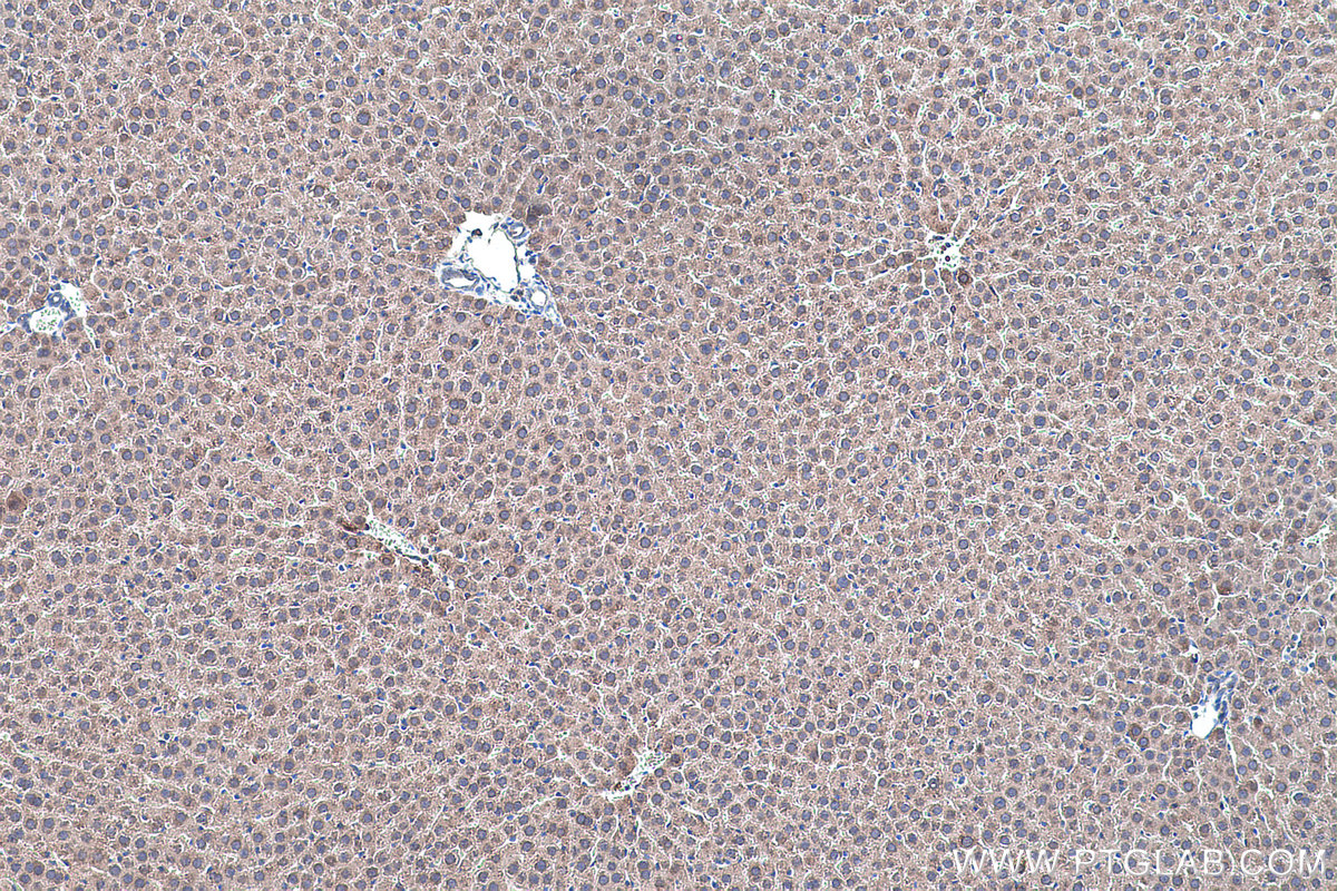 Immunohistochemical analysis of paraffin-embedded rat liver tissue slide using KHC0455 (RSU1 IHC Kit).