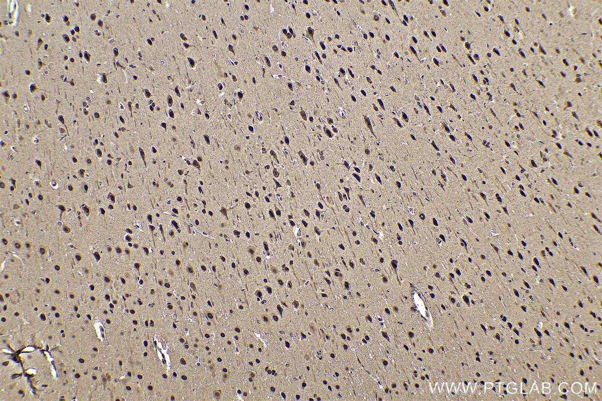 Immunohistochemical analysis of paraffin-embedded rat brain tissue slide using KHC0860 (RTCB IHC Kit).