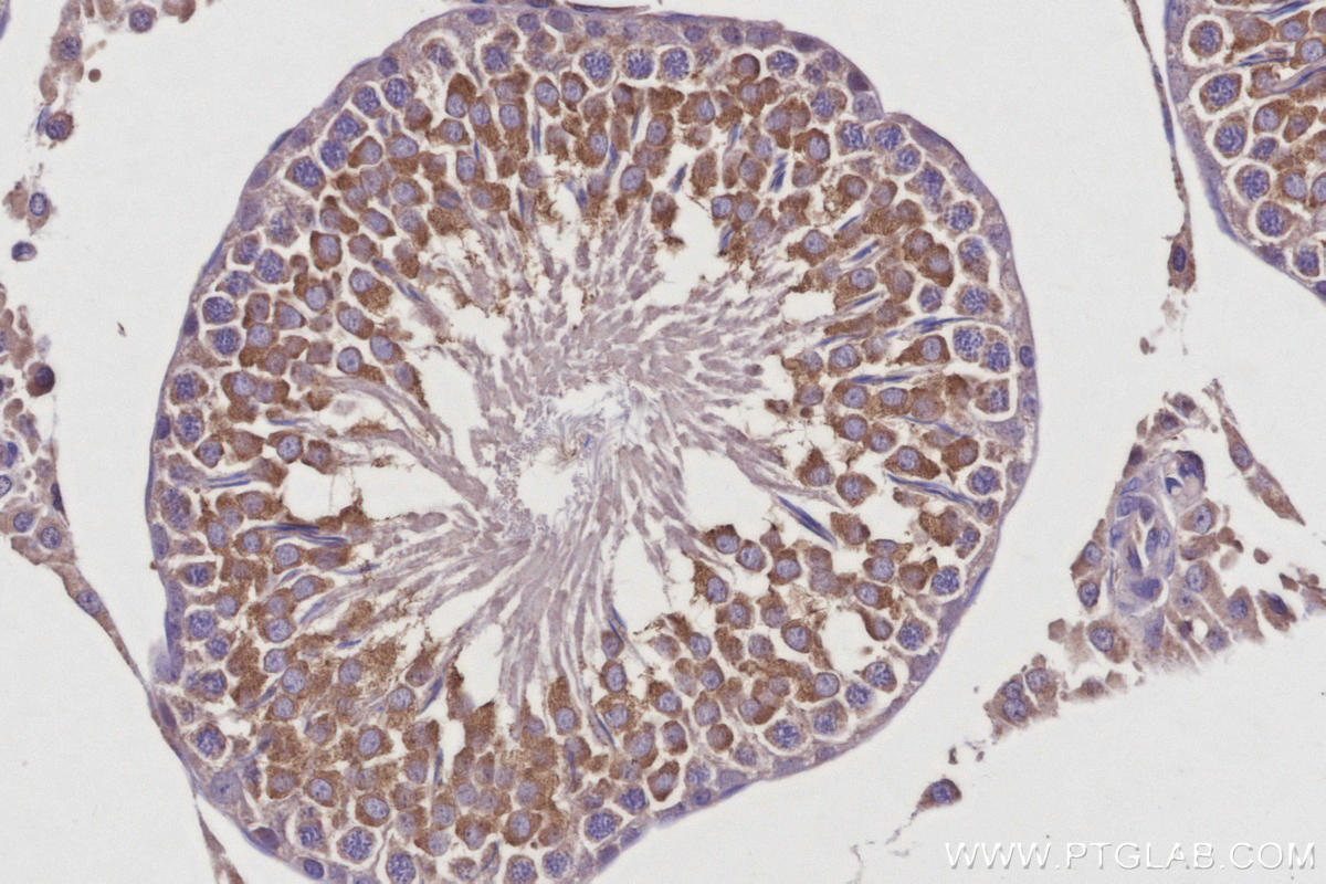 Immunohistochemical analysis of paraffin-embedded rat testis tissue slide using KHC2939 (RTN4/NOGO IHC Kit).
