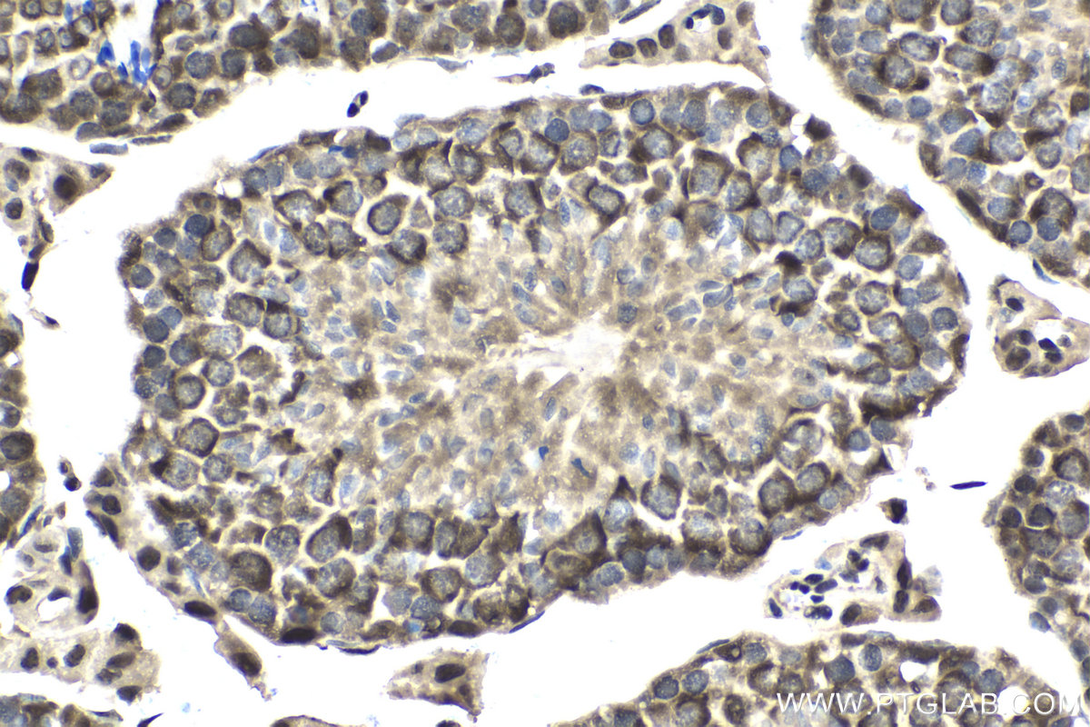 Immunohistochemical analysis of paraffin-embedded mouse testis tissue slide using KHC2011 (RUVBL2 IHC Kit).