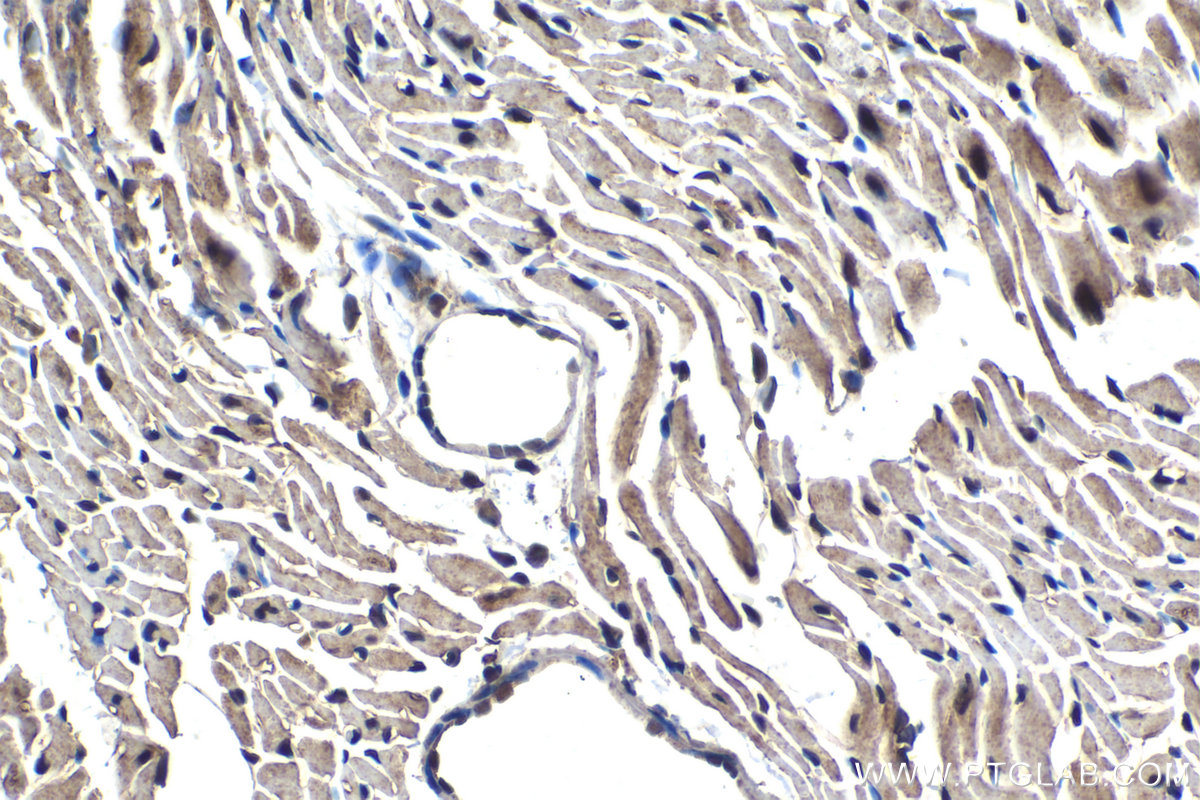 Immunohistochemical analysis of paraffin-embedded mouse heart tissue slide using KHC1603 (RXRA IHC Kit).