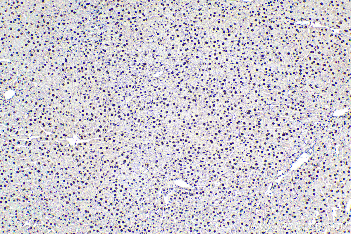 Immunohistochemical analysis of paraffin-embedded rat liver tissue slide using KHC1603 (RXRA IHC Kit).