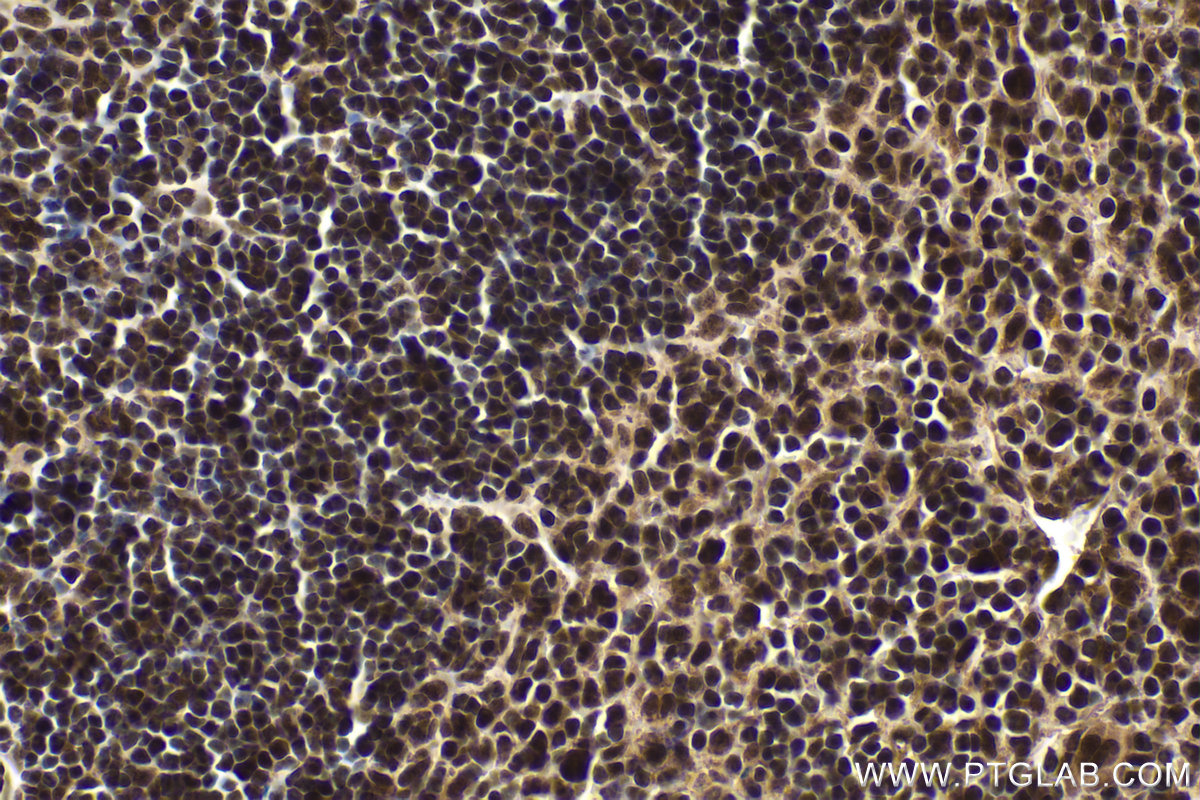 Immunohistochemical analysis of paraffin-embedded mouse spleen tissue slide using KHC1575 (RXRB IHC Kit).