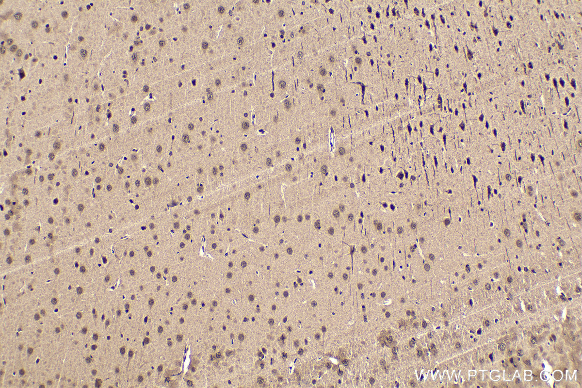 Immunohistochemical analysis of paraffin-embedded rat brain tissue slide using KHC1575 (RXRB IHC Kit).