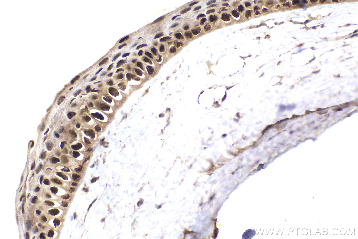 Immunohistochemical analysis of paraffin-embedded rat eye tissue slide using KHC1611 (RXRG IHC Kit).