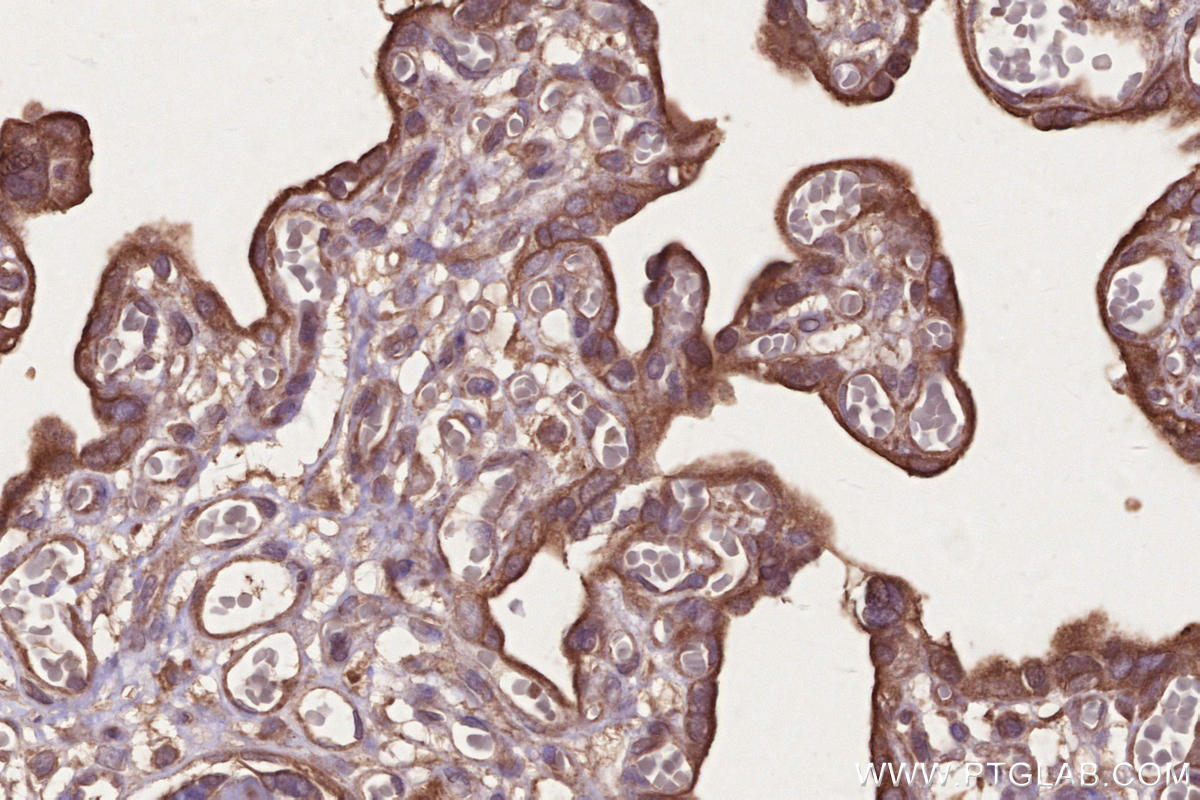 Immunohistochemical analysis of paraffin-embedded human placenta tissue slide using KHC2666 (Raptor IHC Kit).