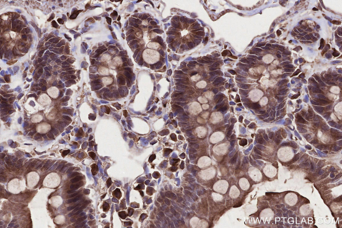Immunohistochemical analysis of paraffin-embedded rat small intestine tissue slide using KHC2666 (Raptor IHC Kit).