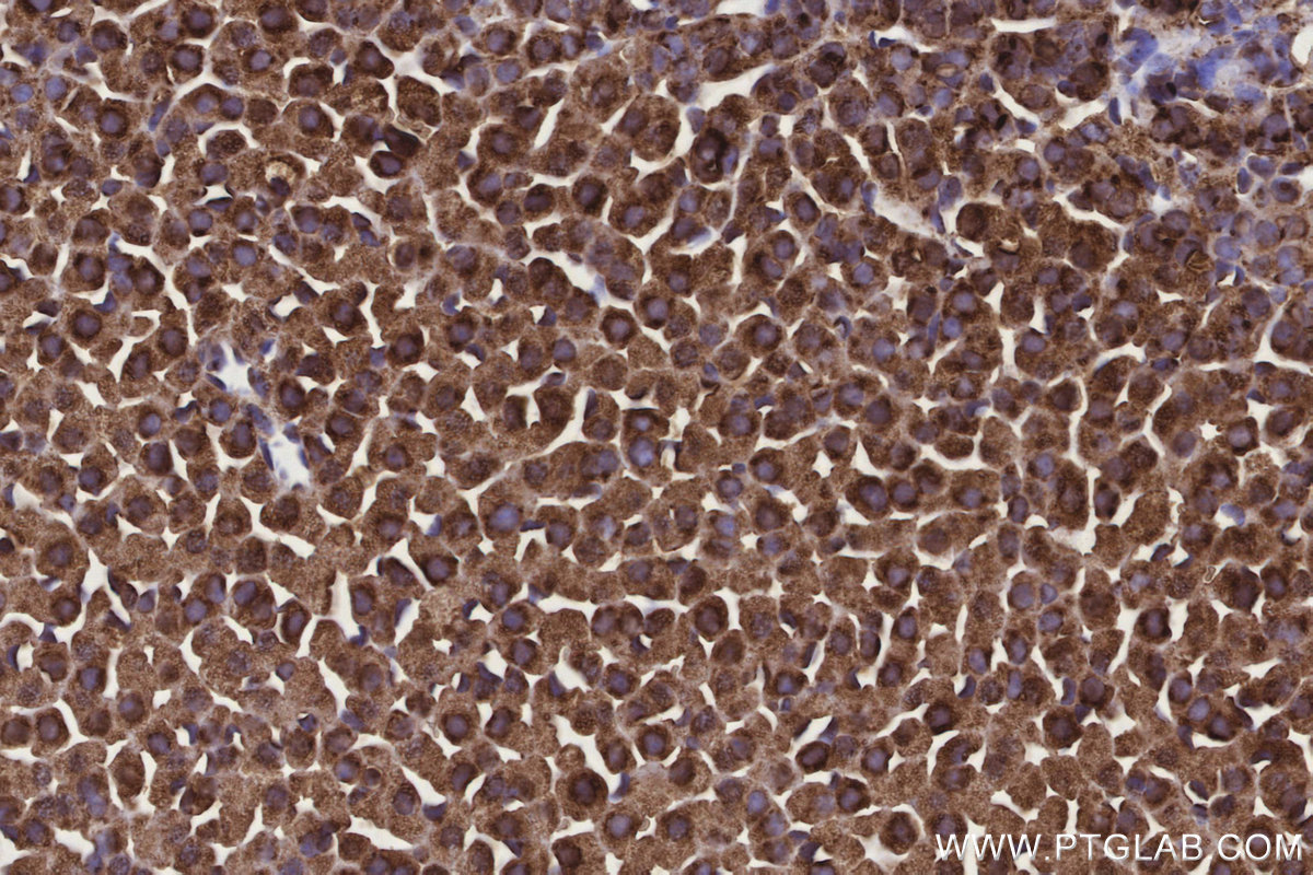 Immunohistochemical analysis of paraffin-embedded mouse adrenal gland tissue slide using KHC3169 (Ribophorin I IHC Kit).