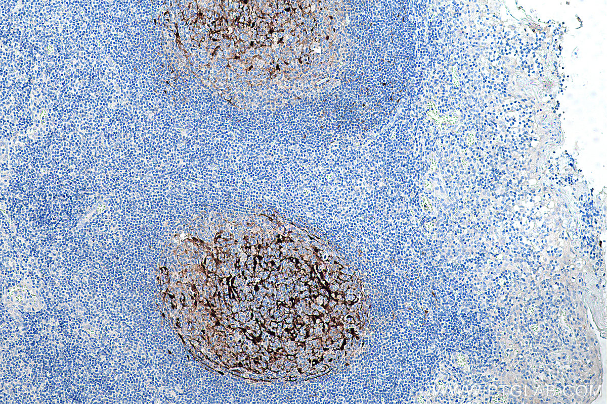 Immunohistochemical analysis of paraffin-embedded human tonsillitis tissue slide using KHC0248 (S100A1 IHC Kit).