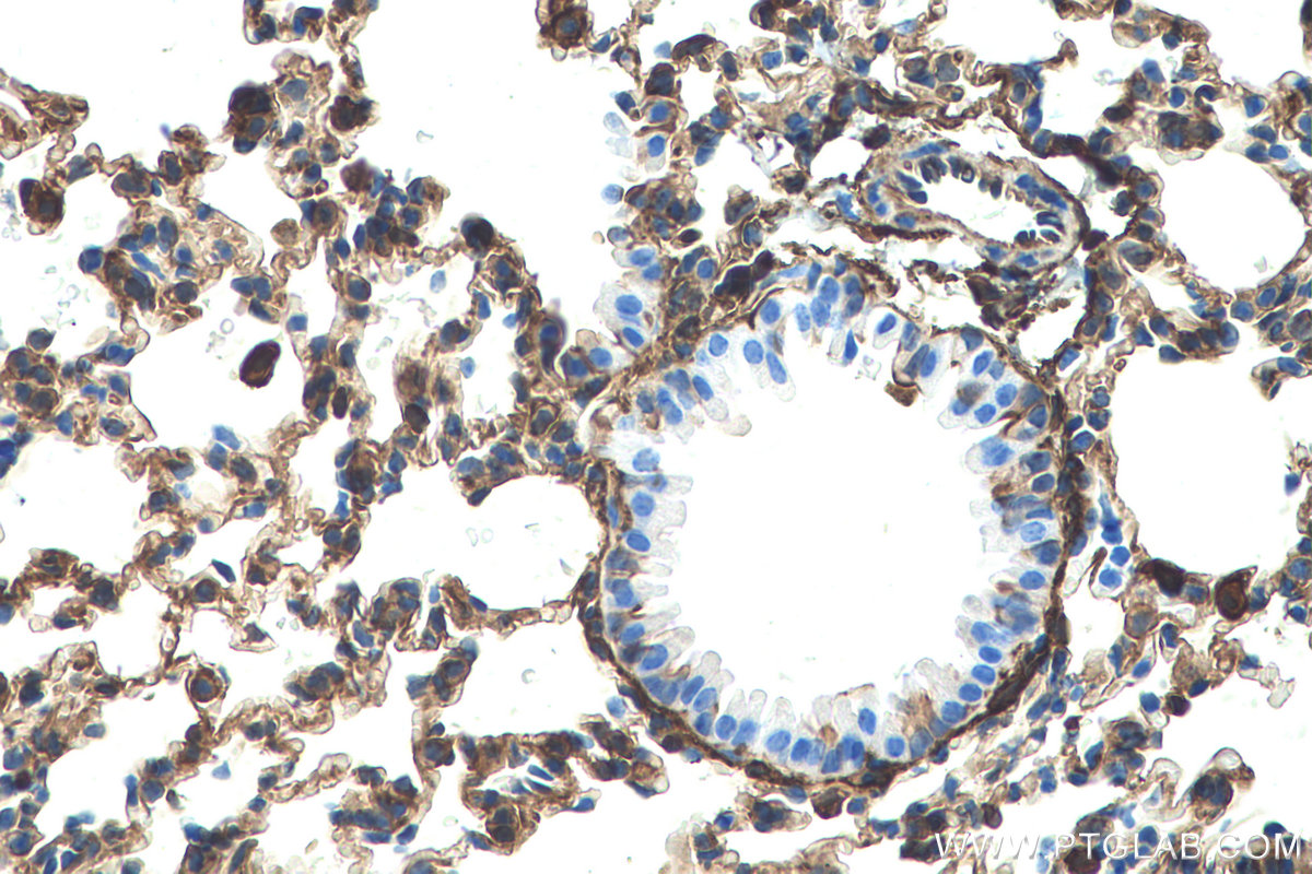 Immunohistochemical analysis of paraffin-embedded mouse lung tissue slide using KHC0528 (S100A10 IHC Kit).