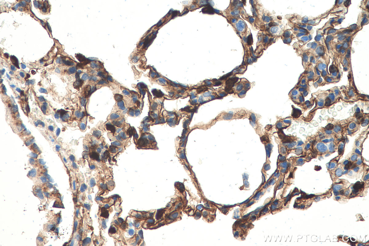 Immunohistochemical analysis of paraffin-embedded rat lung tissue slide using KHC0528 (S100A10 IHC Kit).
