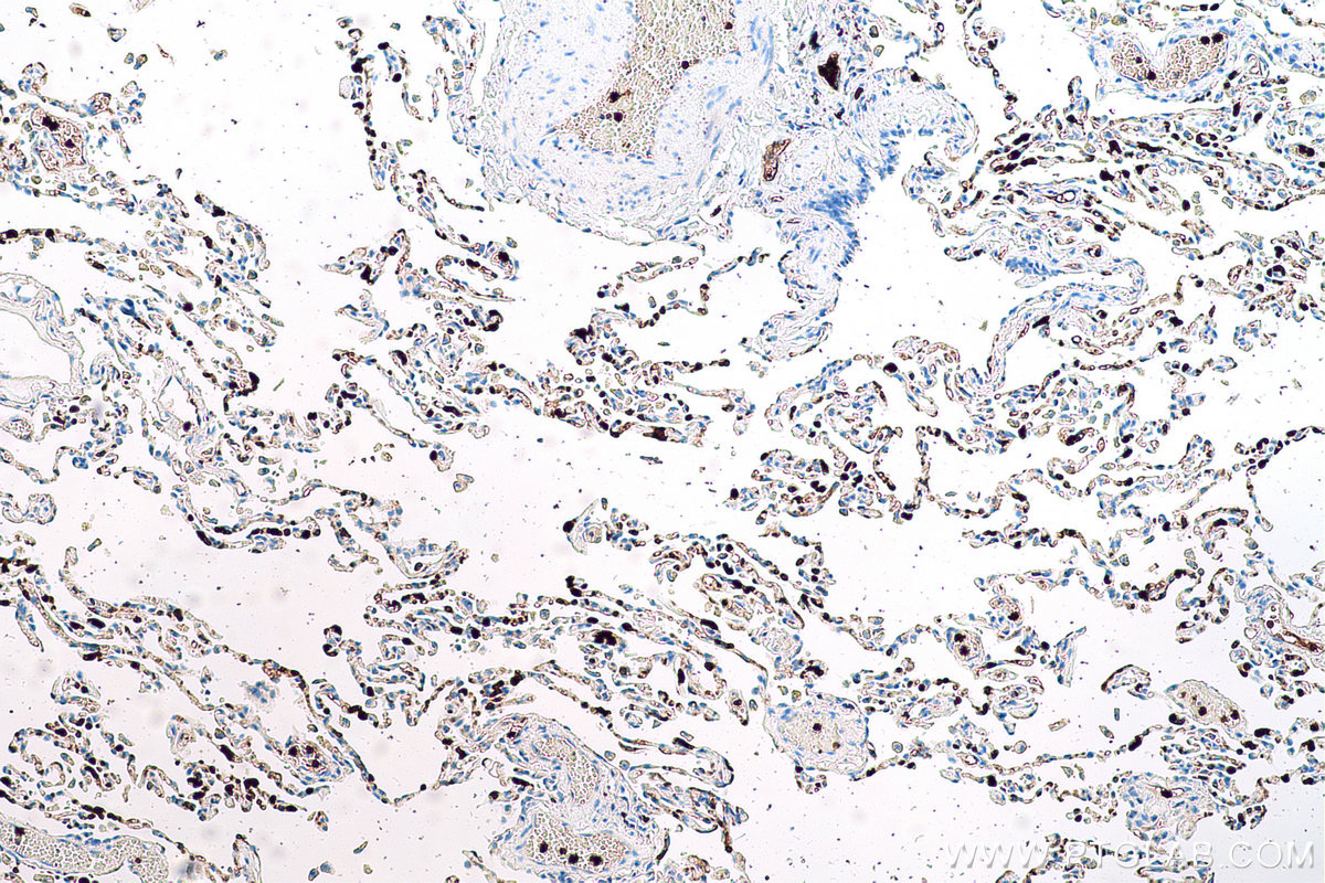 Immunohistochemical analysis of paraffin-embedded human lung tissue slide using KHC0581 (S100A12 IHC Kit).