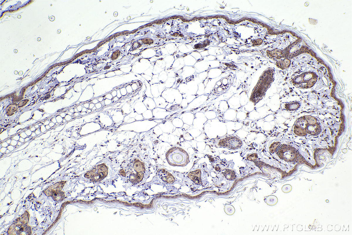 Immunohistochemical analysis of paraffin-embedded rat skin tissue slide using KHC2219 (S100A2 IHC Kit).