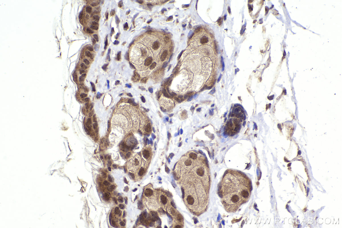 Immunohistochemical analysis of paraffin-embedded mouse skin tissue slide using KHC2219 (S100A2 IHC Kit).