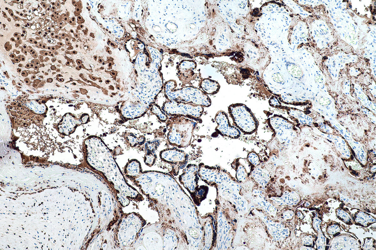 Immunohistochemical analysis of paraffin-embedded human placenta tissue slide using KHC0192 (S100P IHC Kit).