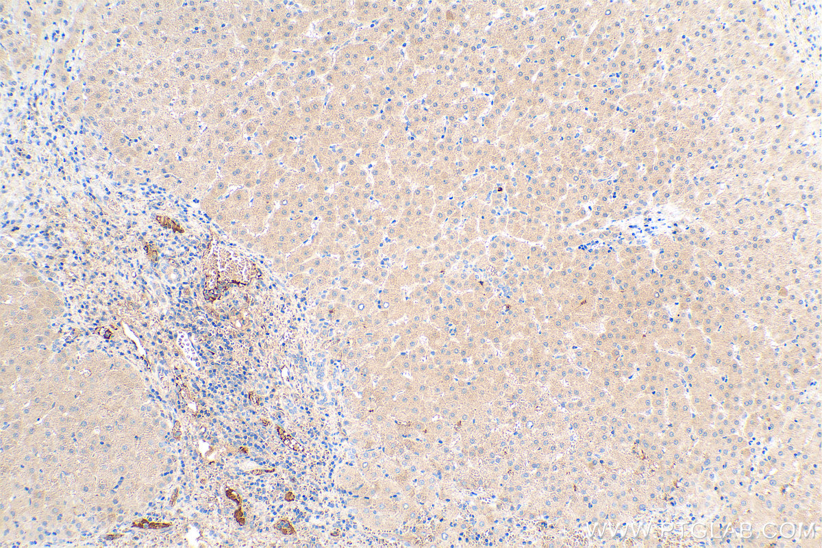 Immunohistochemical analysis of paraffin-embedded human liver tissue slide using KHC0456 (SAA4 IHC Kit).