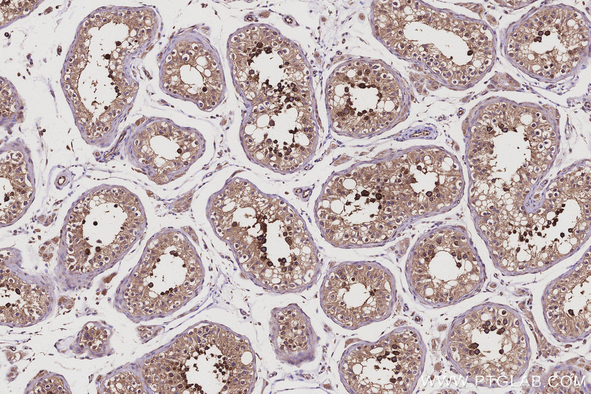 Immunohistochemical analysis of paraffin-embedded human testis tissue slide using KHC3097 (SAC3D1 IHC Kit).