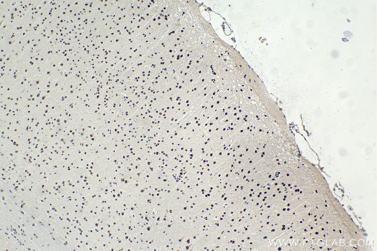 Immunohistochemical analysis of paraffin-embedded mouse brain tissue slide using KHC1752 (SAFB IHC Kit).