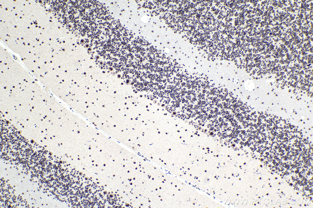 Immunohistochemical analysis of paraffin-embedded rat cerebellum tissue slide using KHC1725 (SAFB2 IHC Kit).