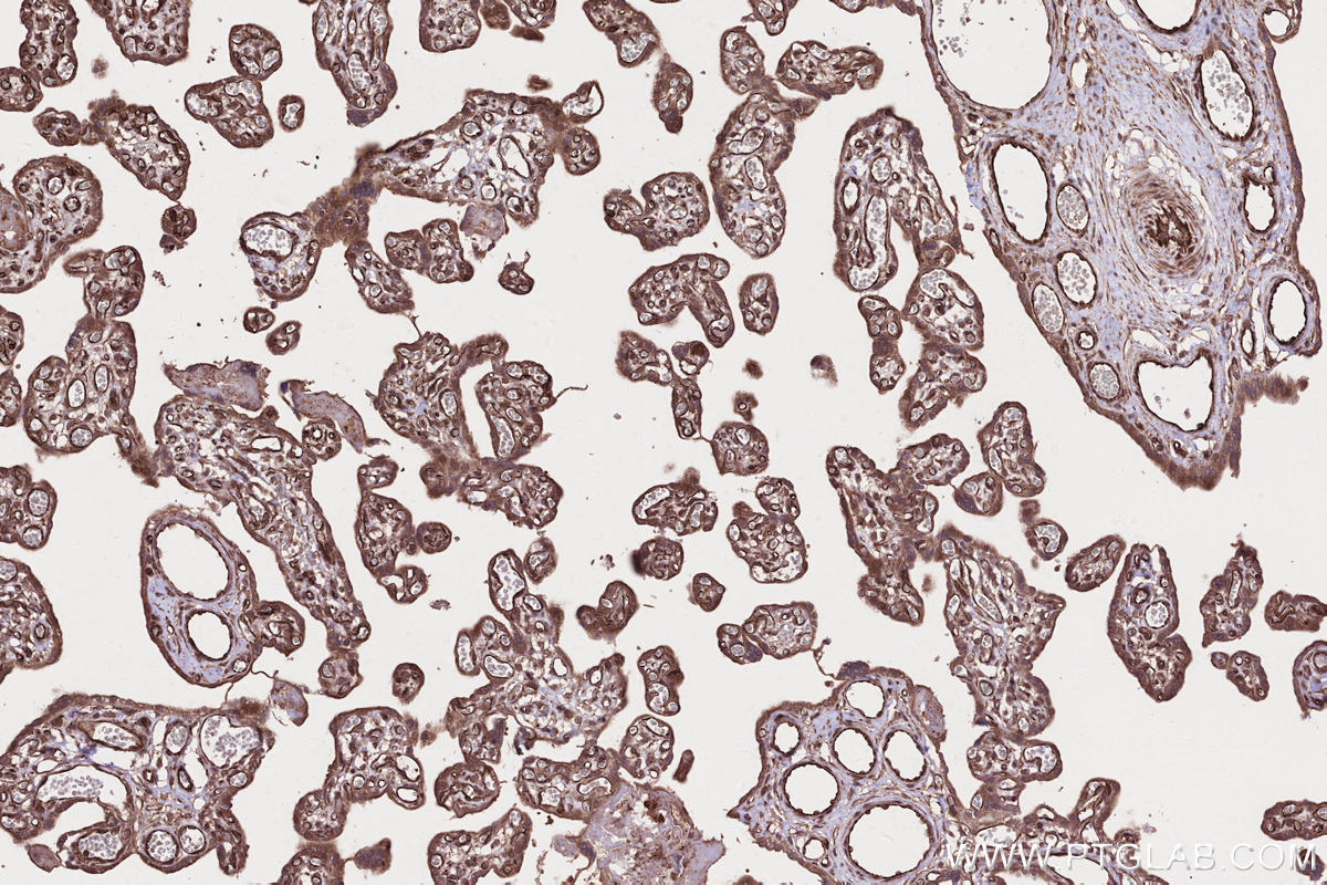 Immunohistochemical analysis of paraffin-embedded human placenta tissue slide using KHC2647 (SAMD9L IHC Kit).
