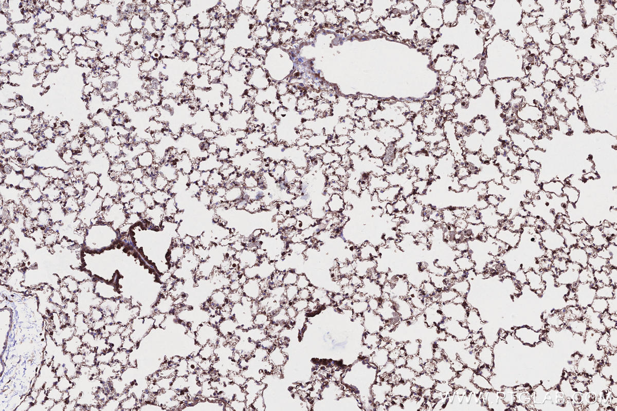 Immunohistochemical analysis of paraffin-embedded mouse lung tissue slide using KHC2647 (SAMD9L IHC Kit).