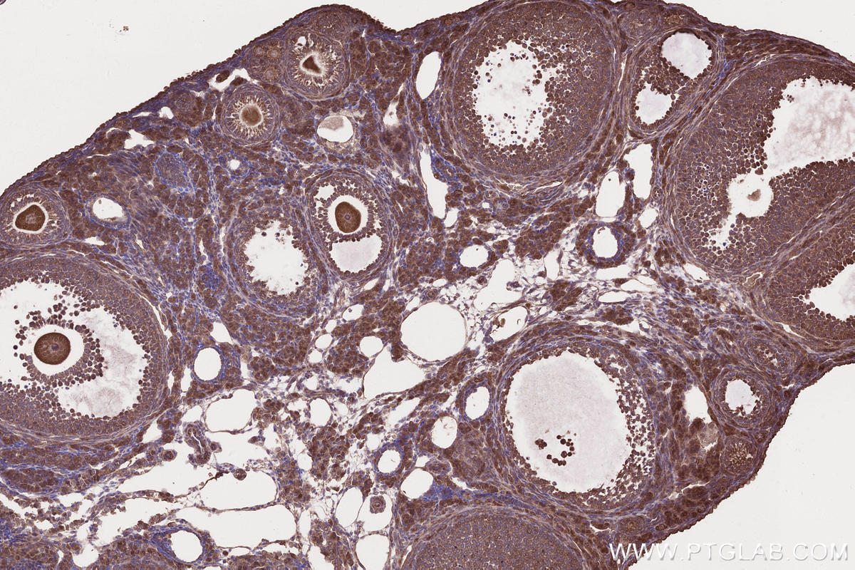 Immunohistochemical analysis of paraffin-embedded mouse ovary tissue slide using KHC2647 (SAMD9L IHC Kit).