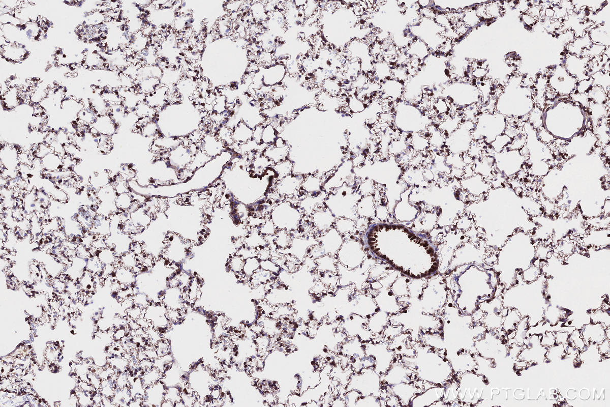 Immunohistochemical analysis of paraffin-embedded rat lung tissue slide using KHC2647 (SAMD9L IHC Kit).