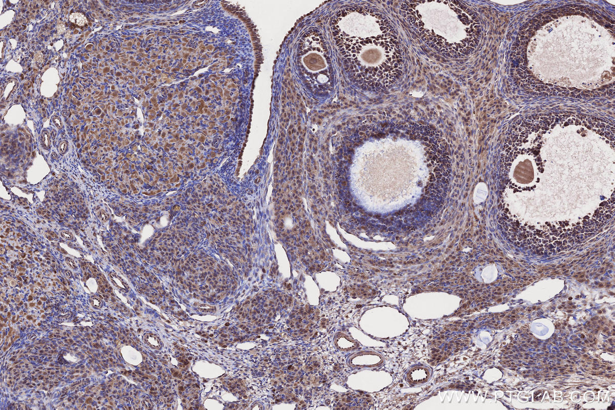 Immunohistochemical analysis of paraffin-embedded rat ovary tissue slide using KHC2647 (SAMD9L IHC Kit).