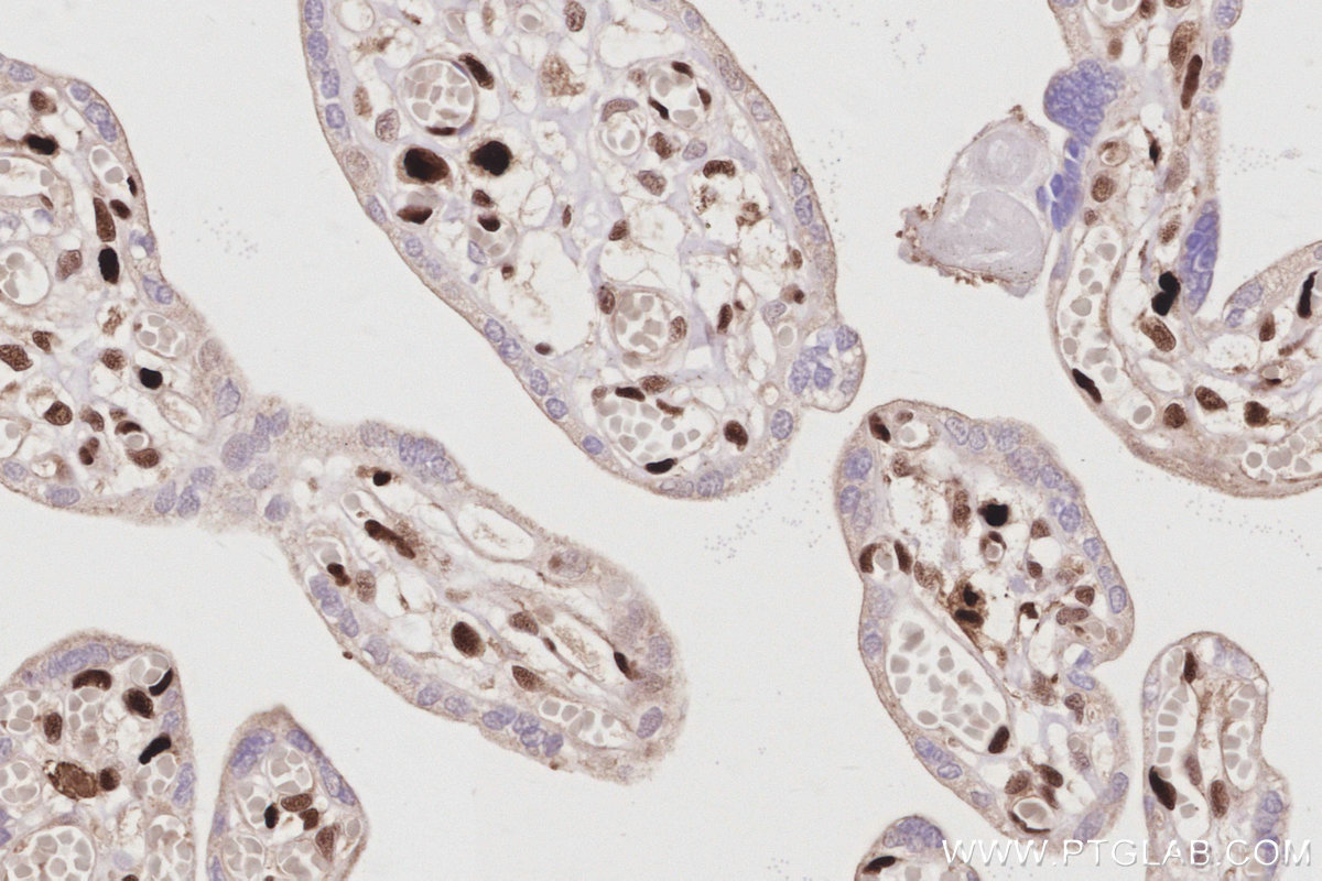 Immunohistochemical analysis of paraffin-embedded human placenta tissue slide using KHC3068 (SAMHD1 IHC Kit). Immunohistochemical analysis of paraffin-embedded human placenta tissue slide using KHC3068 (SAMHD1 IHC Kit).