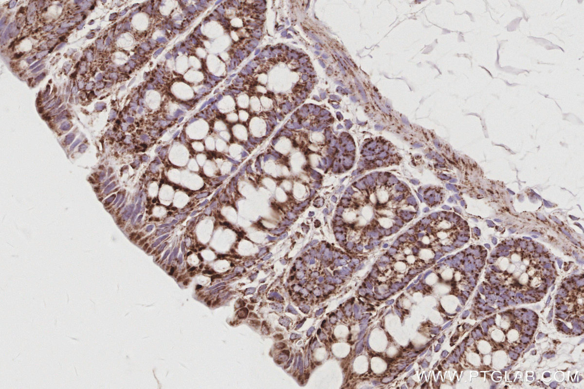 Immunohistochemical analysis of paraffin-embedded rat colon tissue slide using KHC3075 (SAMM50 IHC Kit). Immunohistochemical analysis of paraffin-embedded rat colon tissue slide using KHC3075 (SAMM50 IHC Kit).