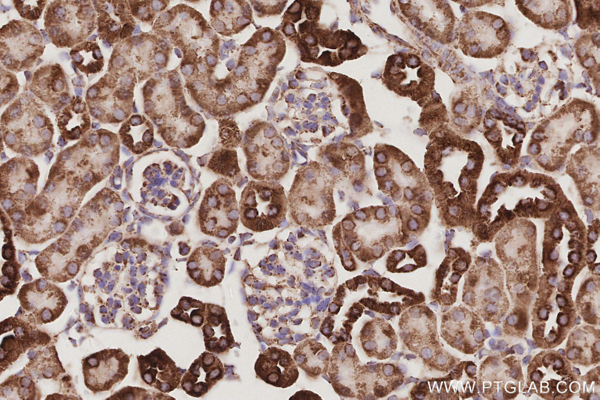 Immunohistochemical analysis of paraffin-embedded mouse kidney tissue slide using KHC3075 (SAMM50 IHC Kit). Immunohistochemical analysis of paraffin-embedded mouse kidney tissue slide using KHC3075 (SAMM50 IHC Kit).