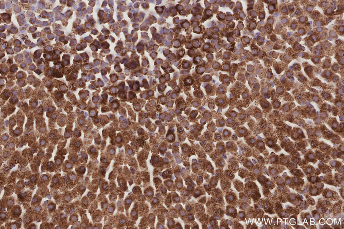 Immunohistochemical analysis of paraffin-embedded mouse adrenal gland tissue slide using KHC3075 (SAMM50 IHC Kit). Immunohistochemical analysis of paraffin-embedded mouse adrenal gland tissue slide using KHC3075 (SAMM50 IHC Kit).