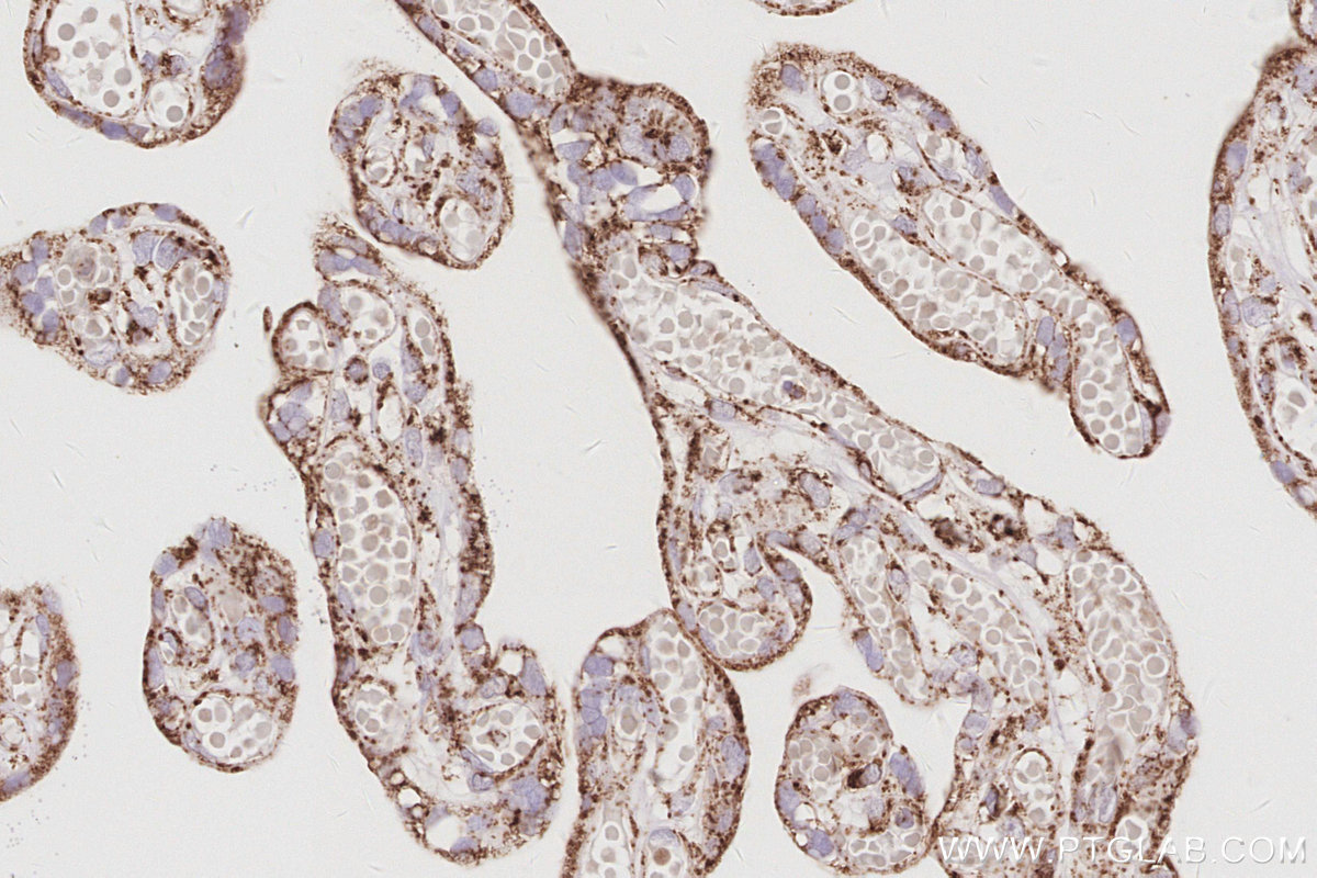 Immunohistochemical analysis of paraffin-embedded human placenta tissue slide using KHC3075 (SAMM50 IHC Kit). Immunohistochemical analysis of paraffin-embedded human placenta tissue slide using KHC3075 (SAMM50 IHC Kit).
