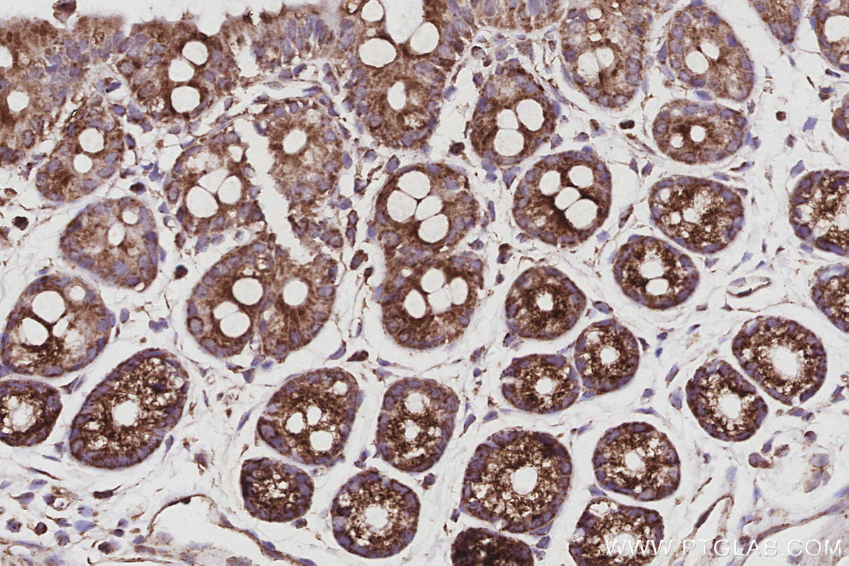 Immunohistochemical analysis of paraffin-embedded mouse colon tissue slide using KHC3075 (SAMM50 IHC Kit). Immunohistochemical analysis of paraffin-embedded mouse colon tissue slide using KHC3075 (SAMM50 IHC Kit).