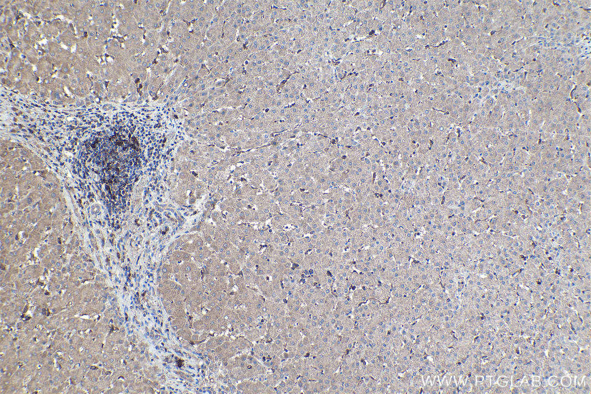 Immunohistochemical analysis of paraffin-embedded human liver tissue slide using KHC1965 (SAMSN1 IHC Kit).