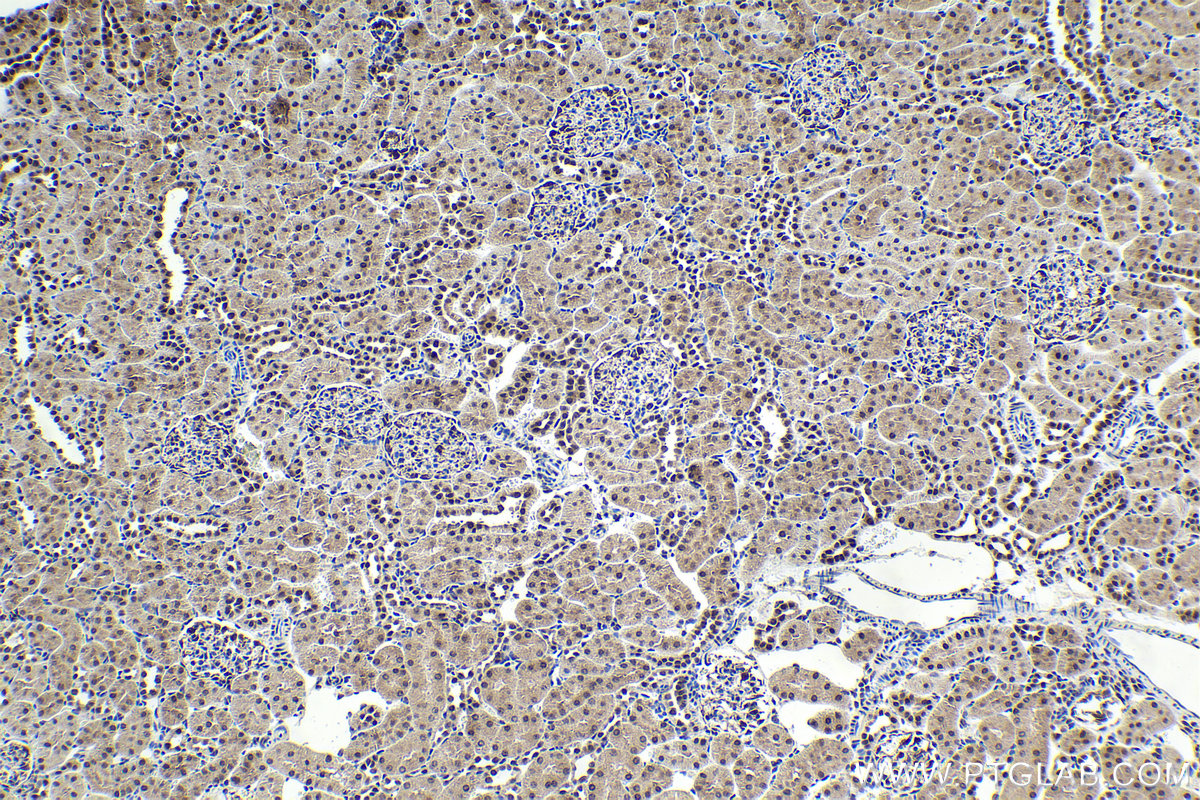 Immunohistochemical analysis of paraffin-embedded rat kidney tissue slide using KHC1746 (SART3 IHC Kit).