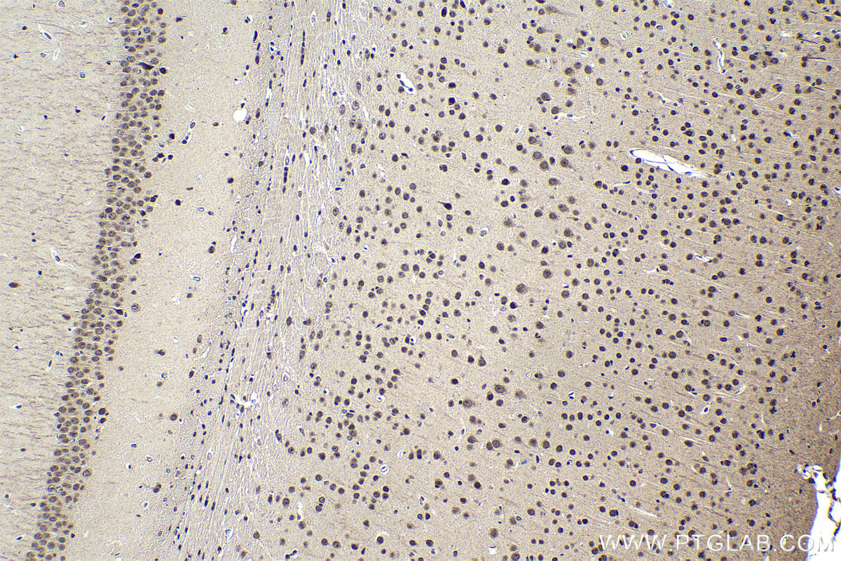 Immunohistochemical analysis of paraffin-embedded mouse brain tissue slide using KHC1746 (SART3 IHC Kit).