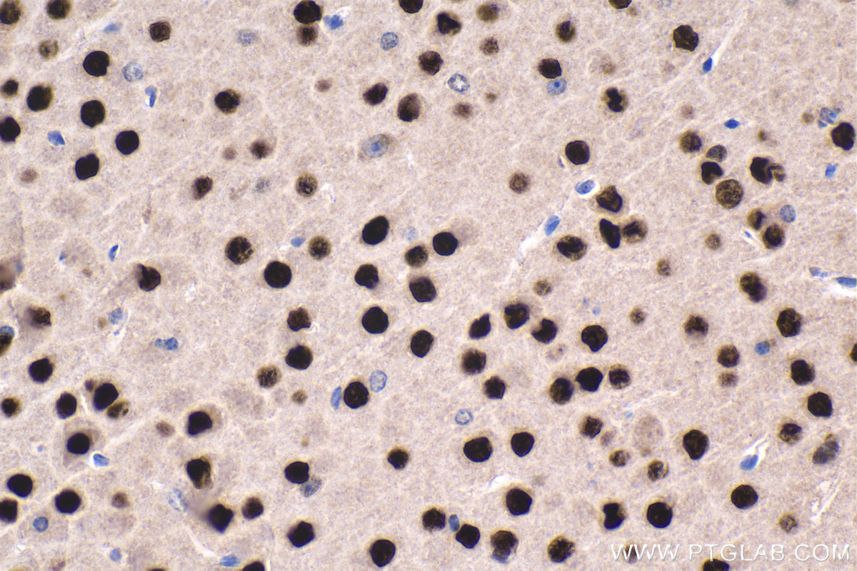 Immunohistochemical analysis of paraffin-embedded mouse brain tissue slide using KHC1666 (SATB1 IHC Kit).