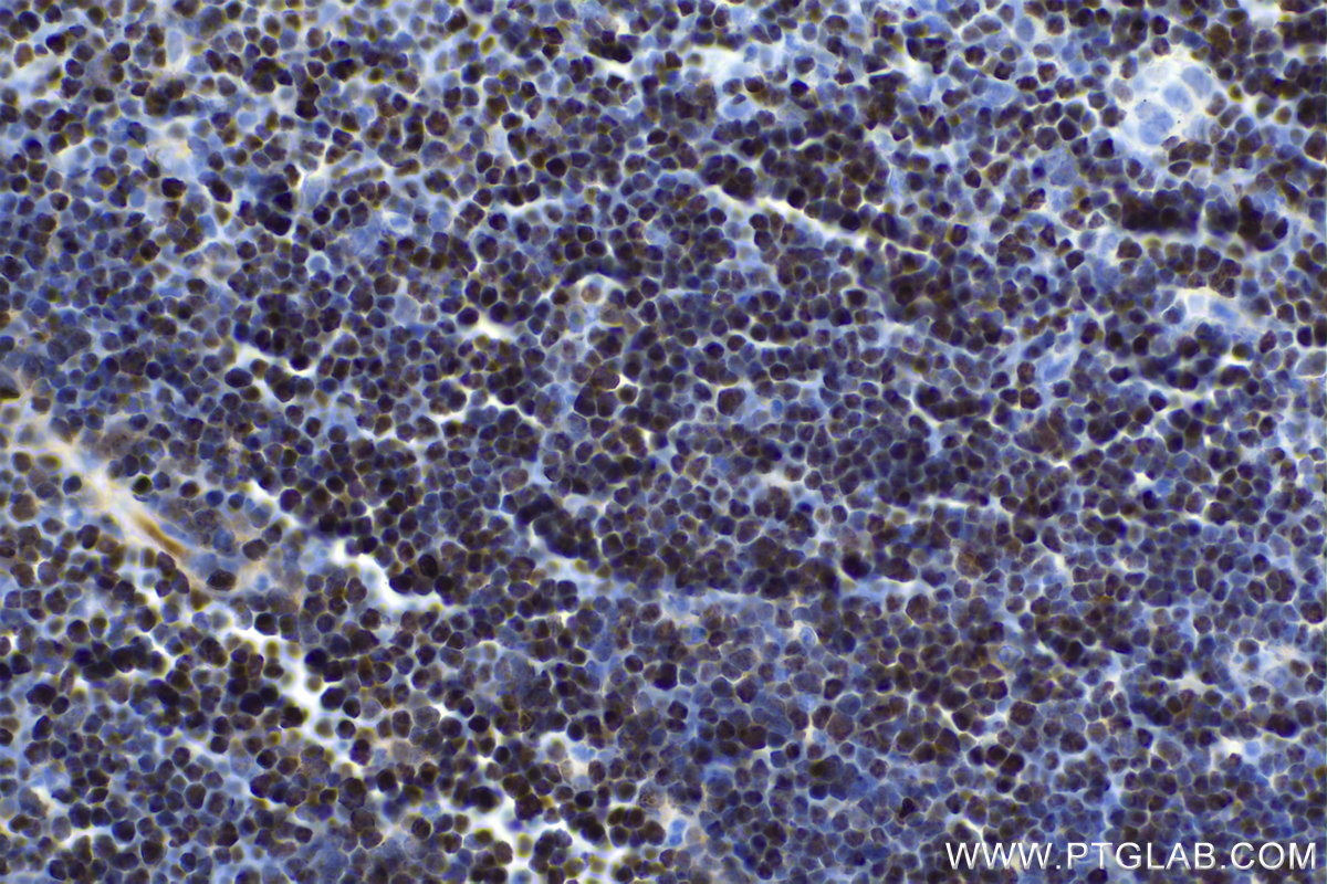 Immunohistochemical analysis of paraffin-embedded mouse thymus tissue slide using KHC1666 (SATB1 IHC Kit).