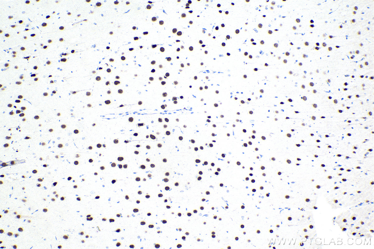 Immunohistochemical analysis of paraffin-embedded rat brain tissue slide using KHC1666 (SATB1 IHC Kit).