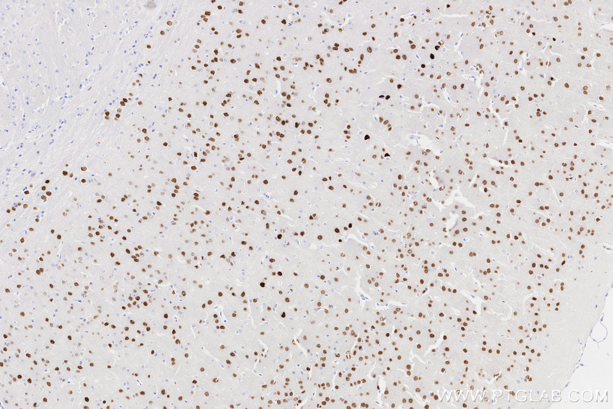 Immunohistochemical analysis of paraffin-embedded mouse brain tissue slide using KHC3314 (SATB2 IHC Kit). Immunohistochemical analysis of paraffin-embedded mouse brain tissue slide using KHC3314 (SATB2 IHC Kit).