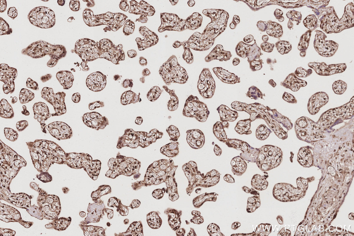 Immunohistochemical analysis of paraffin-embedded human placenta tissue slide using KHC3060 (SBDS IHC Kit). Immunohistochemical analysis of paraffin-embedded human placenta tissue slide using KHC3060 (SBDS IHC Kit).