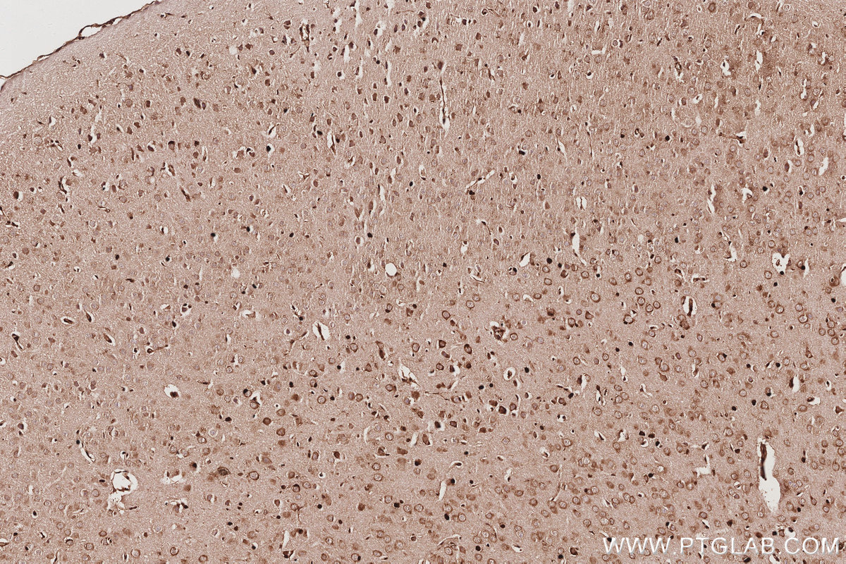 Immunohistochemical analysis of paraffin-embedded mouse brain tissue slide using KHC3060 (SBDS IHC Kit). Immunohistochemical analysis of paraffin-embedded mouse brain tissue slide using KHC3060 (SBDS IHC Kit).